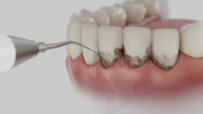 Reliable Dental contractor in Austin, TX by Smile Center Dentistry